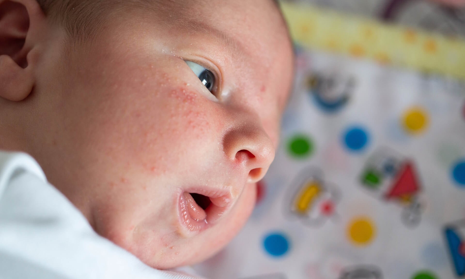 Is That a Rash? Common Baby Skin Conditions and How to Handle Them