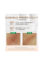 Load image into Gallery viewer, Pigeon Natural Botanical Maternity Stretch Marks Serum 40ml