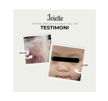 Joielle Baby Cream With Extra Virgin Coconut Oil Special Edition