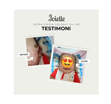 Joielle Baby Cream With Extra Virgin Coconut Oil Special Edition