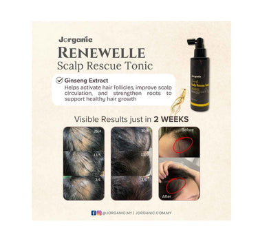 Jorganic Renewelle Scalp Rescue Tonic 150ml