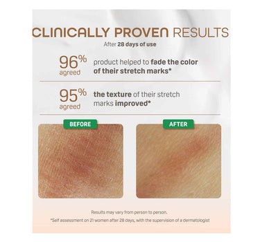 Pigeon Natural Botanical Maternity Stretch Marks Serum 40ml